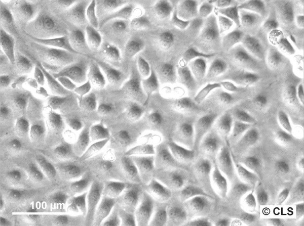 ECV-304 Cells