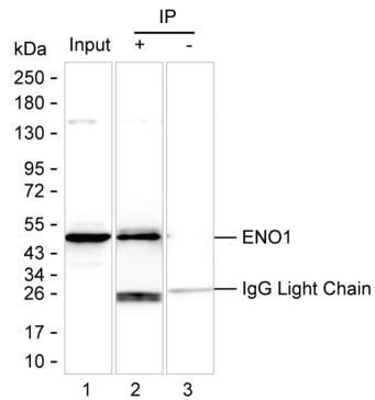 Anti-ENO1
