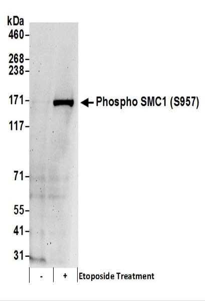 Anti-phospho-SMC1 (Ser957)