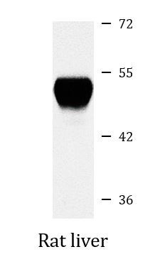 Anti-ALT / Alanine Transaminase