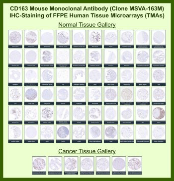 Anti-CD163, clone MSVA-163M