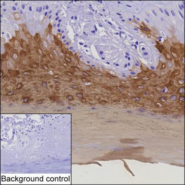 Anti-Cytokeratin-9