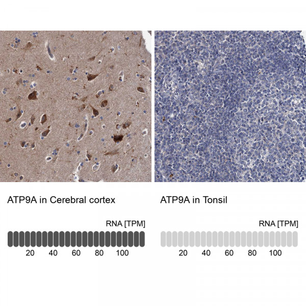 Anti-ATP9A