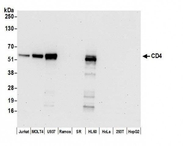 Anti-CD4 Recombinant Monoclonal