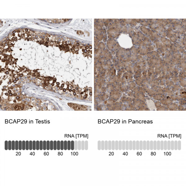 Anti-BCAP29