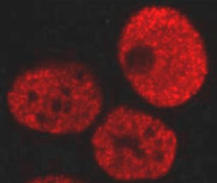Anti-Ubiquitin (linkage-specific K48)