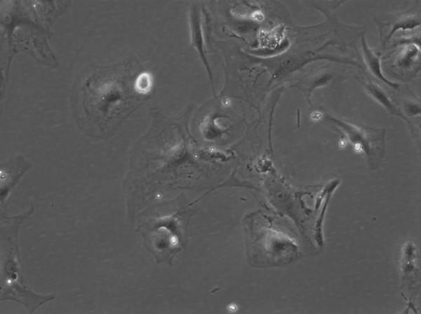 HROG33 Cells
