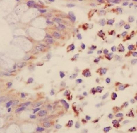 Anti-phospho-PKR (Thr446)