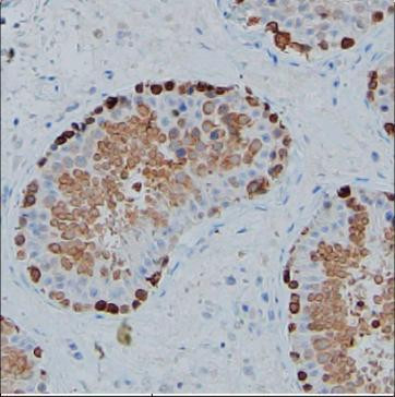 Anti-HSP90AA1