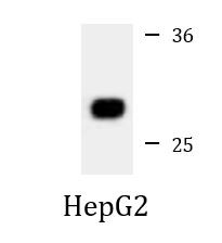 Anti-CTDSP1