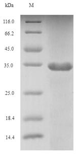 Fibroblast growth factor 10 (FGF10), partial, recombinant human