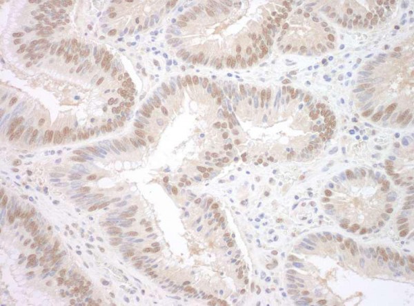 Anti-SPF45 (IHC)