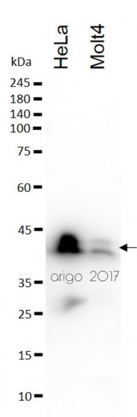 Anti-CD99, clone SQab1725
