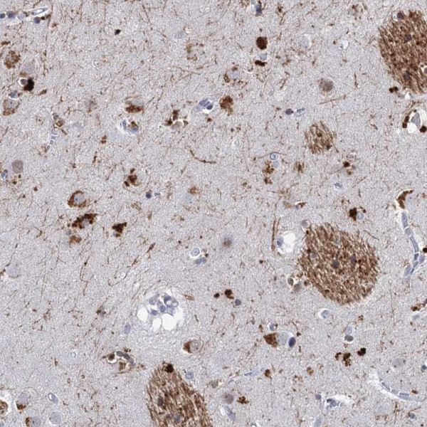 Anti-C16orf72