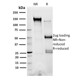 Anti-XRCC3, clone 10F1/6