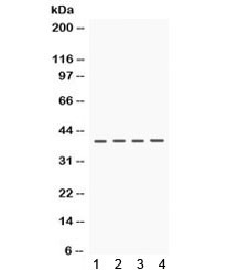 Anti-CSNK1A1
