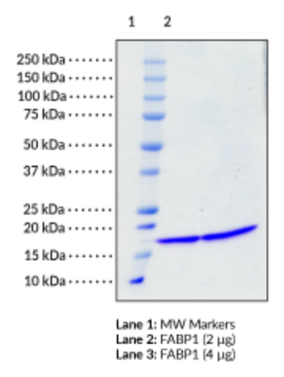 FABP1 (human, recombinant)