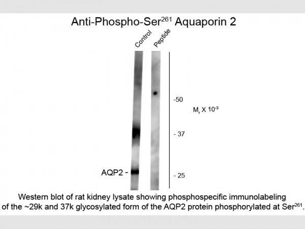 Anti-phospho-Aquaporin 2 (Ser261)
