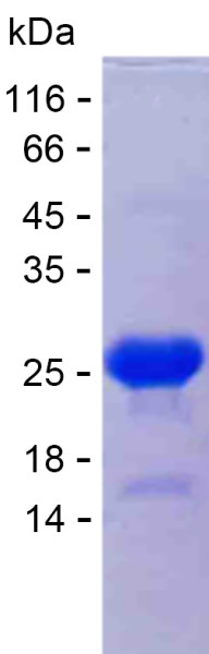 Recombinant Human TRMT2A Protein