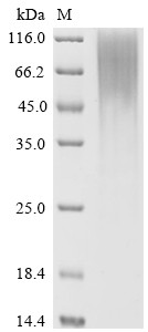 Non-secretory ribonuclease (RNASE2), human, recombinant