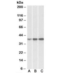 Anti-IDH3A