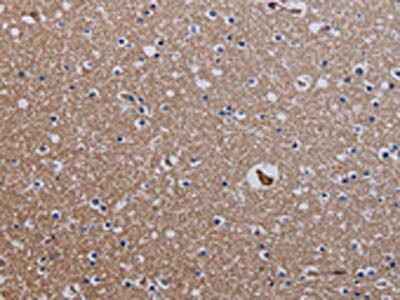 Anti-ZC3H12A