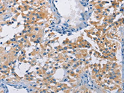Anti-ATP6AP2