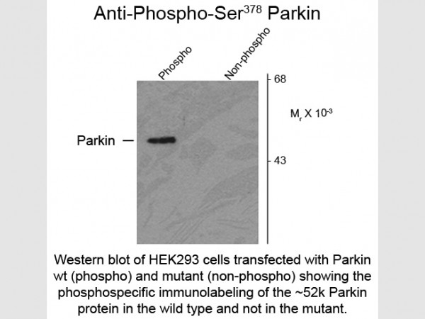 Anti-phospho-Parkin (Ser378)