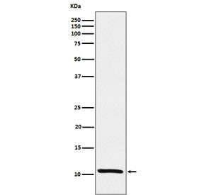 Anti-Estrogen Inducible Protein pS2 / TFF1, clone ADIB-20