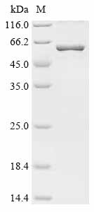 Matrix metalloproteinase-25 (MMP25), human, recombinant
