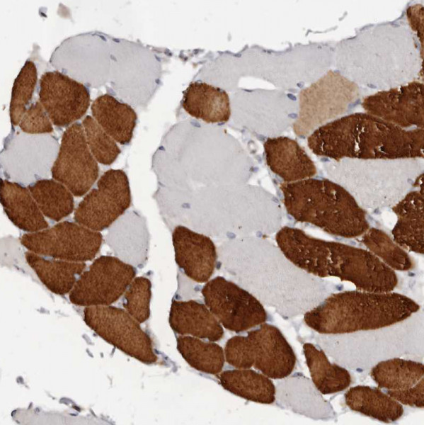 Anti-TNNI1
