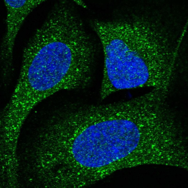 Anti-CDK5RAP3
