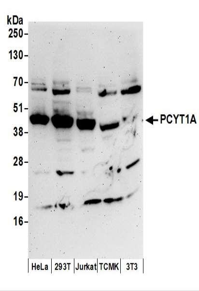 Anti-PCYT1A