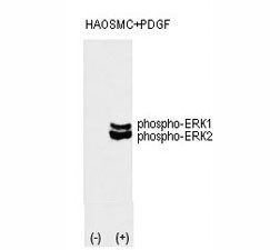 Anti-phospho-ERK1/2 [p-ERK1/2] (Thr202/Tyr204)