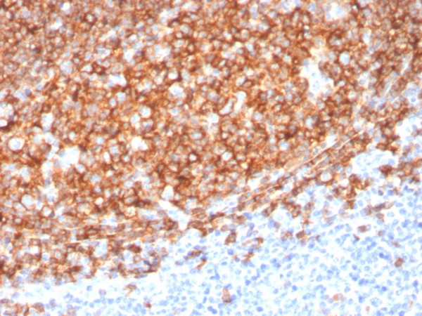Anti-CD20 / MS4A1 (B-Cell Marker), clone MS4A1/3410