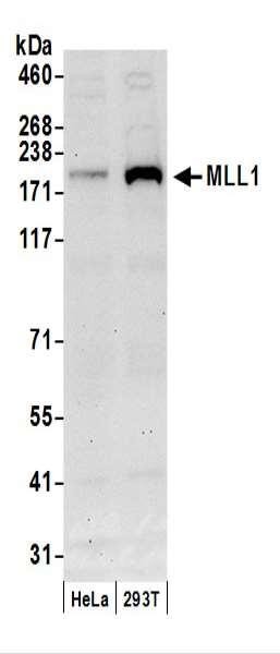 Anti-MLL1