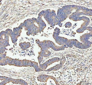 Anti-ARHGEF12 / Rho guanine nucleotide exchange factor 12