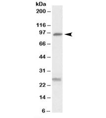 Anti-SLC4A11