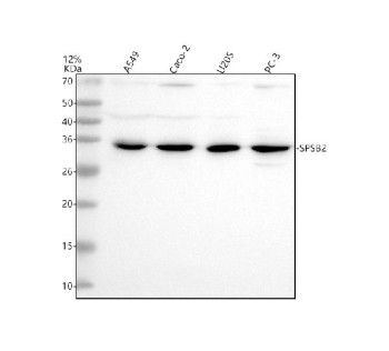 Anti-SPSB2 / SplA/Ryanodine receptor domain and SOCS box containing protein 2