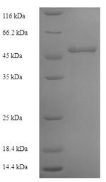 Ornithine transcarbamylase, mitochondrial (OTC), human, recombinant