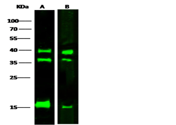 Anti-LMAN2/VIP36 Monoclonal Antibody