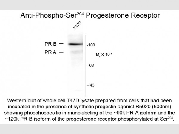 Anti-phospho-Progesterone Receptor (Ser294), clone 608