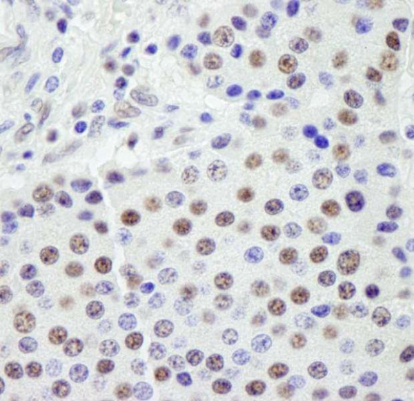Anti-SF3a120/SAP114 (IHC)