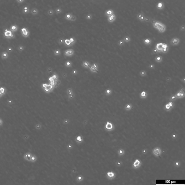 SK-ES-1 Cells
