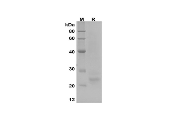 Recombinant SARS-CoV-2 E Protein