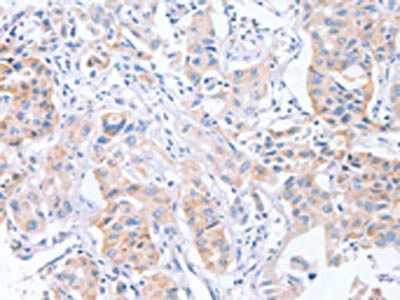 Anti-CDCA4