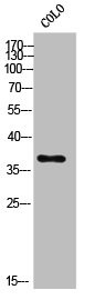 Anti-AKR1C2