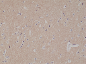 Anti-CD56 (human), Rabbit Monoclonal (RM315)