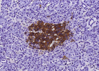 Anti-IGFBP7 Monoclonal Recombinant Antibody