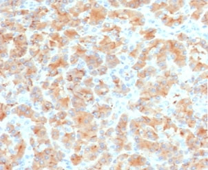 Anti-Glycoprotein 2 / GP2 / ZAP75, clone PSGMG2-2R